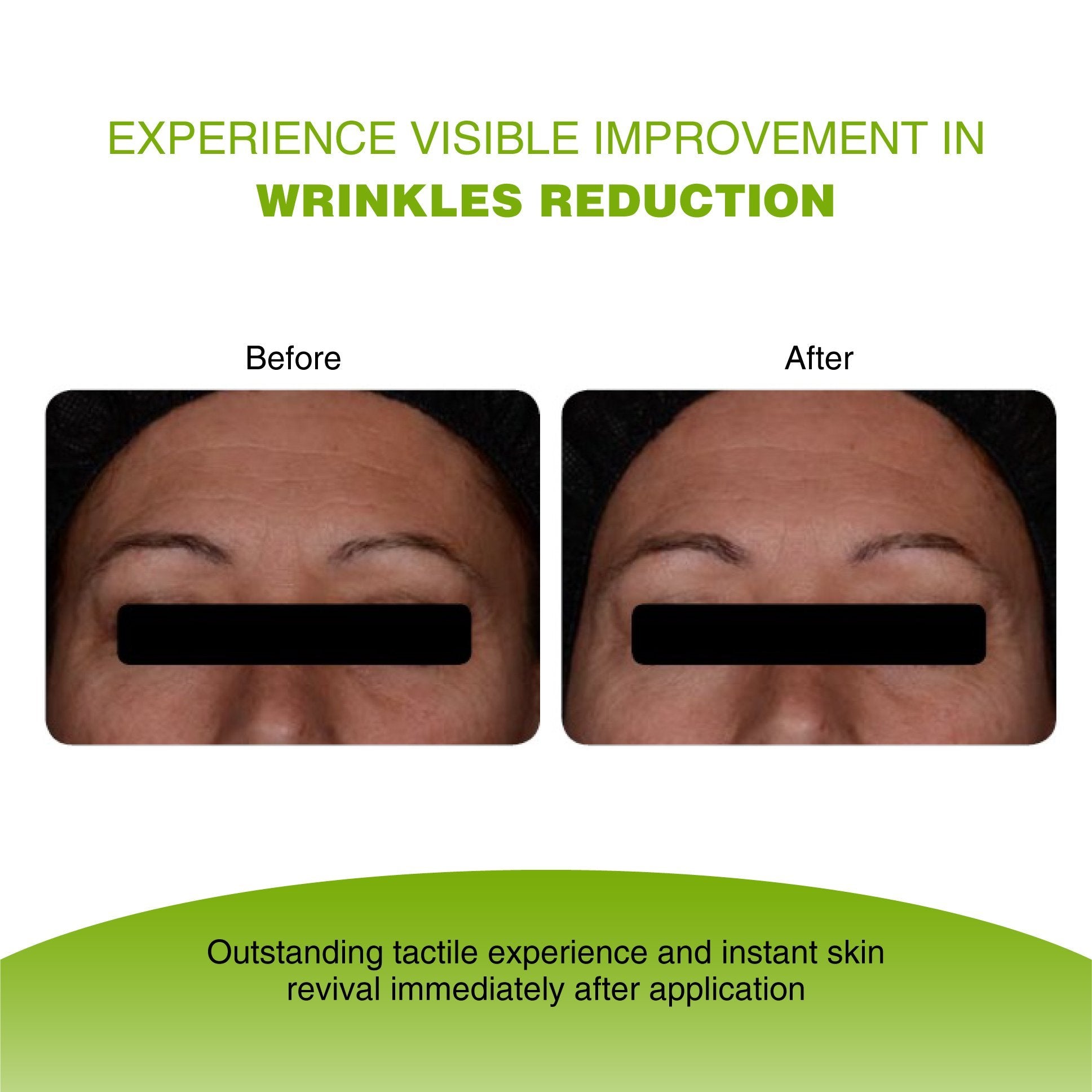 Vijuve Vitamin C Face Serum with Double Hyaluronic Acid and Collagen